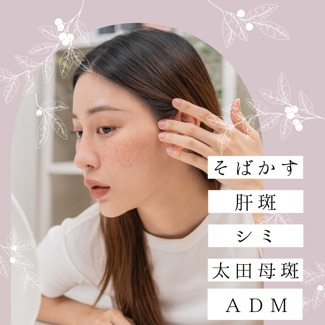 【善は急げ！】川口で受けたいシミ取り施術とホームケアをご紹介