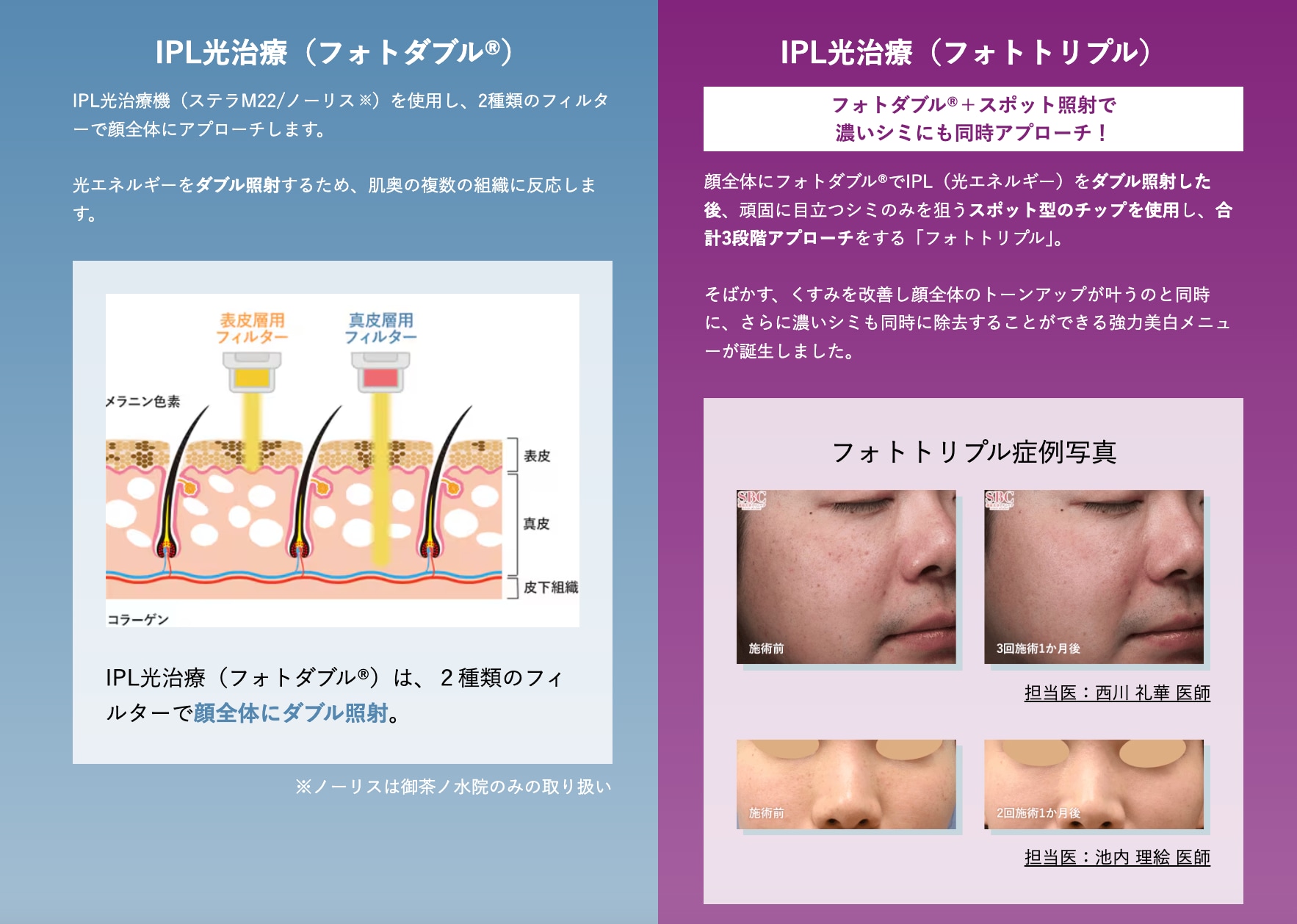 フォトダブルって？