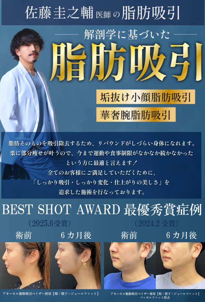 【8/6までお得なキャンペーン実施中！】【小顔脂肪吸引最優秀賞Dr】全国トップクラスの脂肪吸引✨