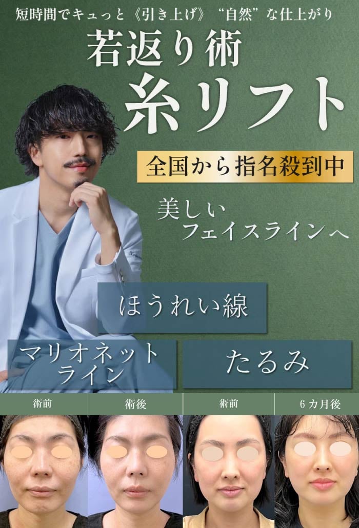 【8/6までお得なキャンペーン実施中！】【耳鼻咽喉・頭頚部外科出身】指導医が認めたデザイン力【芸術的な糸リフト】で、もたつきを解消！