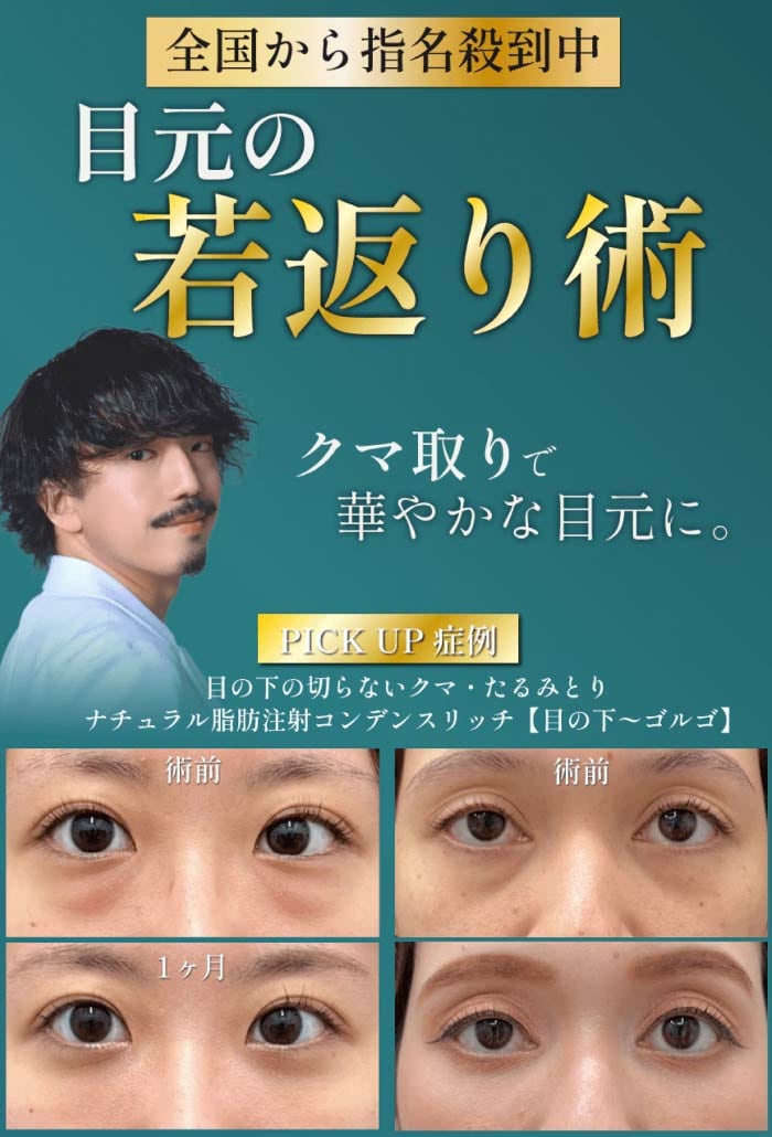 【8/6までお得なキャンペーン実施中！】【耳鼻咽喉・頭頸部外科出身】オーダーメイドのクマ治療で圧倒的な若返りを実現いたします！