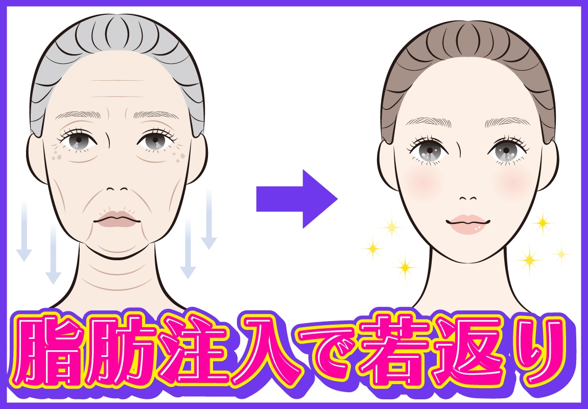 【比較】おでこを丸くするならどっち？ヒアルロン酸と脂肪注入、失敗しないためのデメリット徹底解説✨