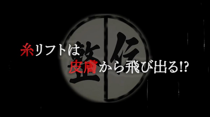 糸リフトは皮膚から飛び出る？