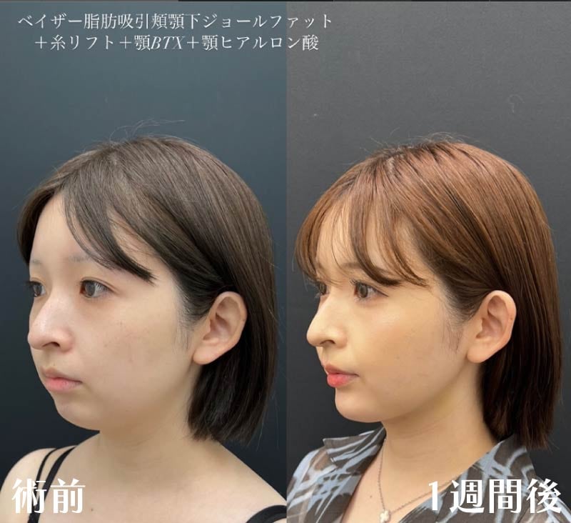 20代女性