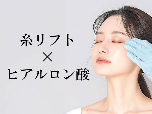 「糸リフト」と「ヒアルロン酸」の組み合わせ
