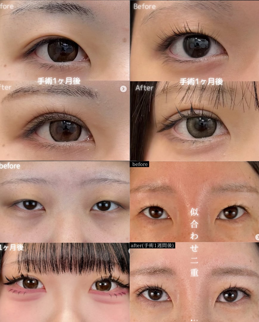 得意施術