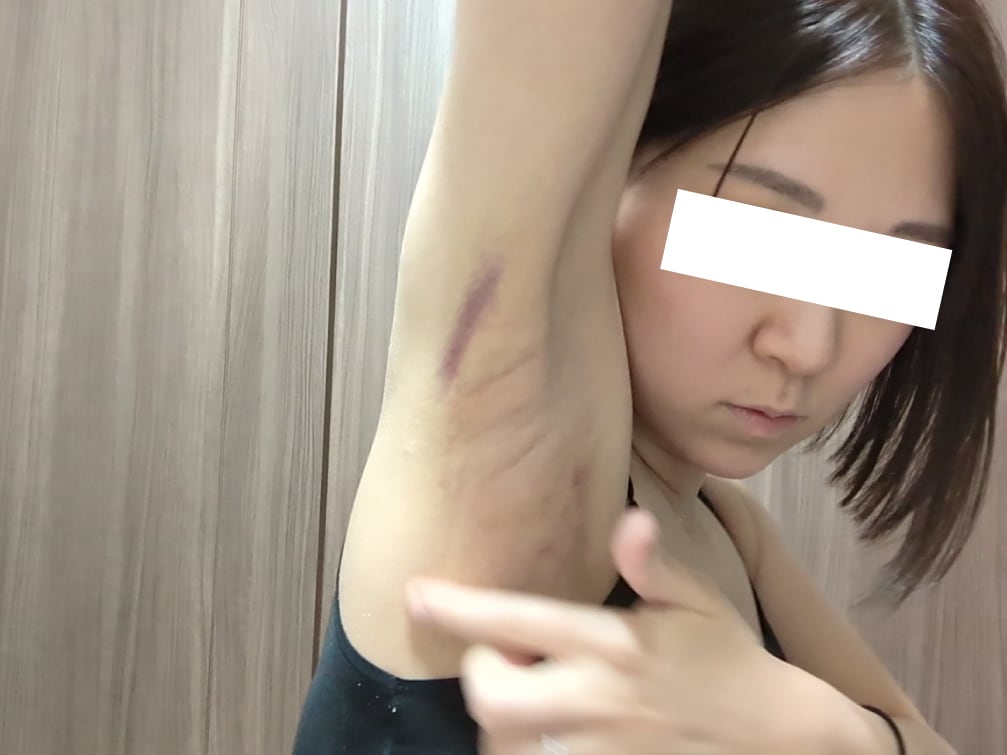 治療の第一歩は無料カウンセリングから