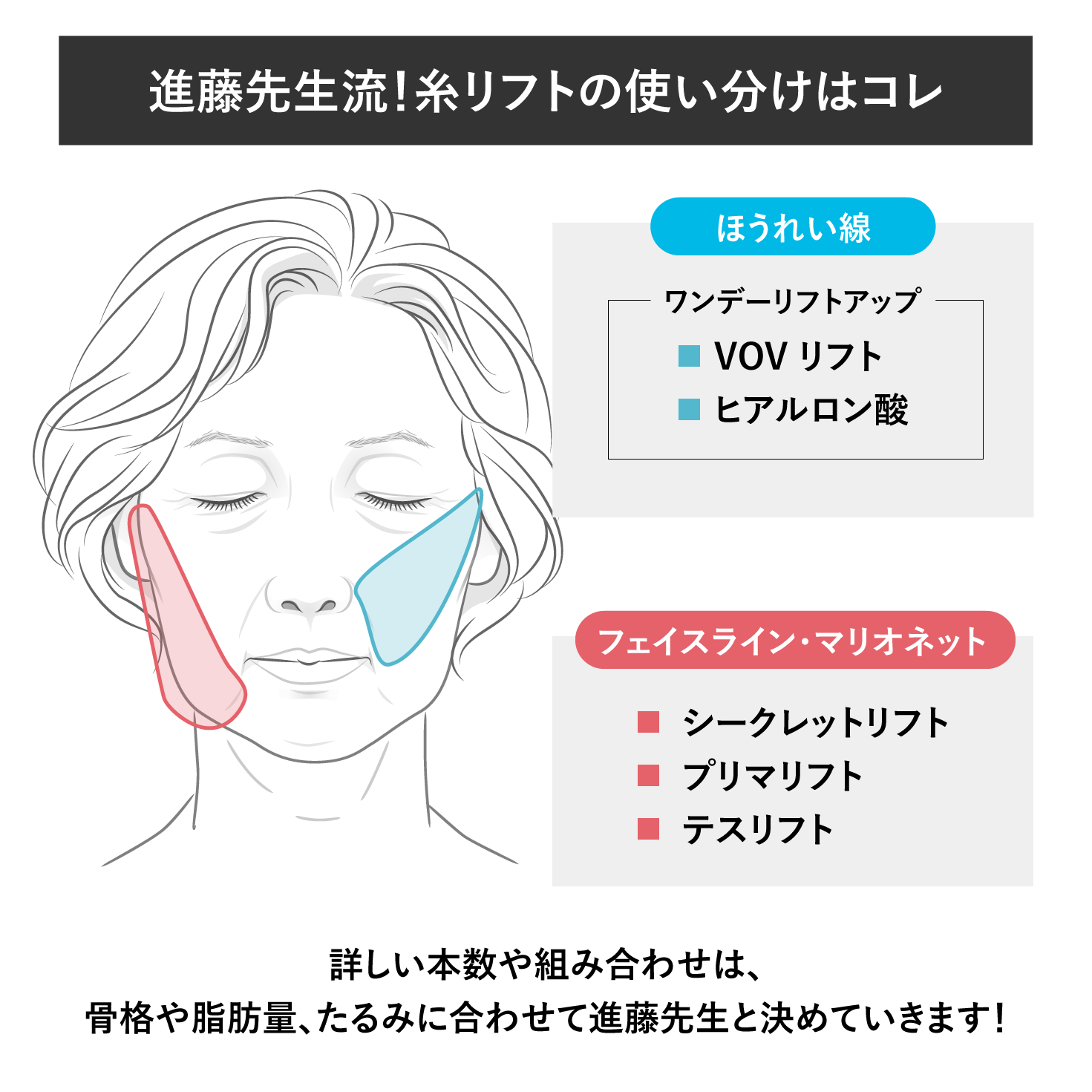 進藤先生が使う糸リフトの種類は？