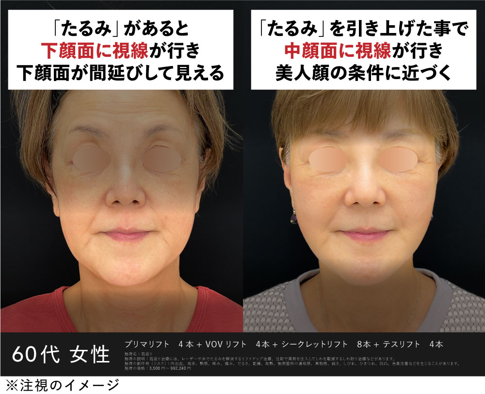 Dr．進藤の若返り術なら「視線誘導」で黄金比に
