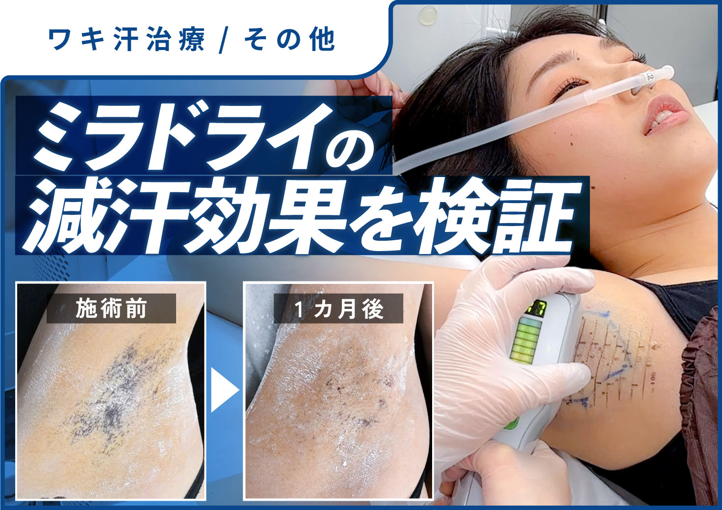 「あれ？ワキ汗、大丈夫かな？」って心配をなくしませんか？