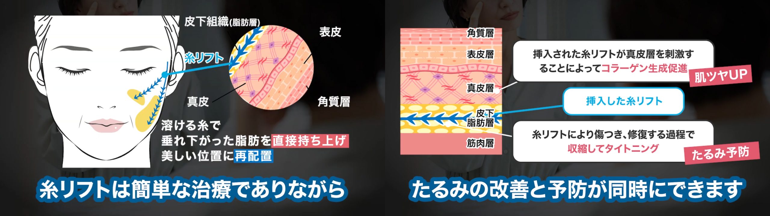 体に負担が少ない治療なのに改善＆予防