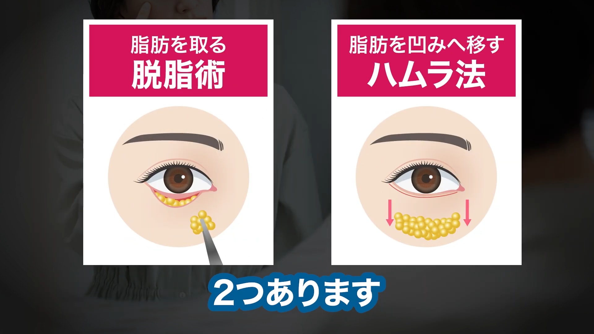 治療方法は大きく分けて2つ