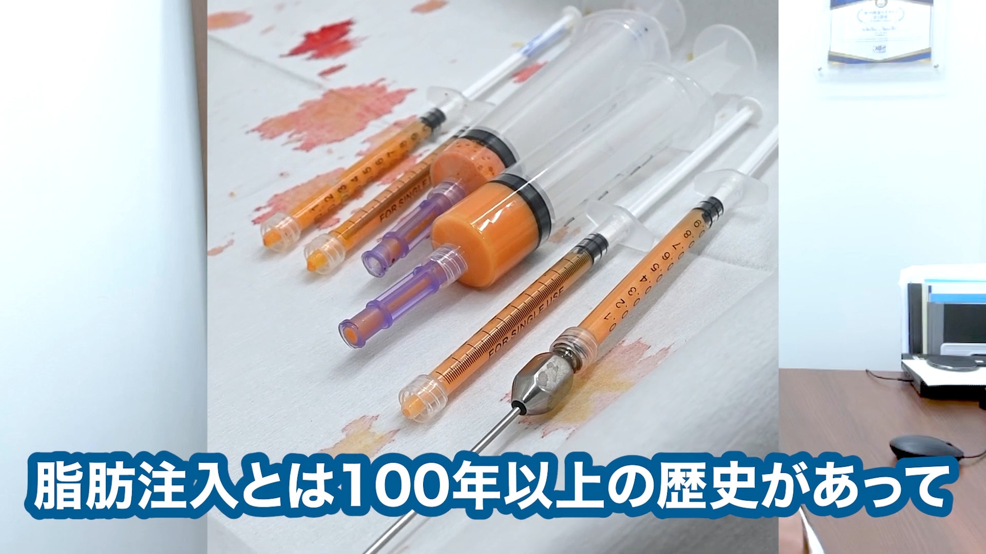 クマ取りと一緒に脂肪注入？