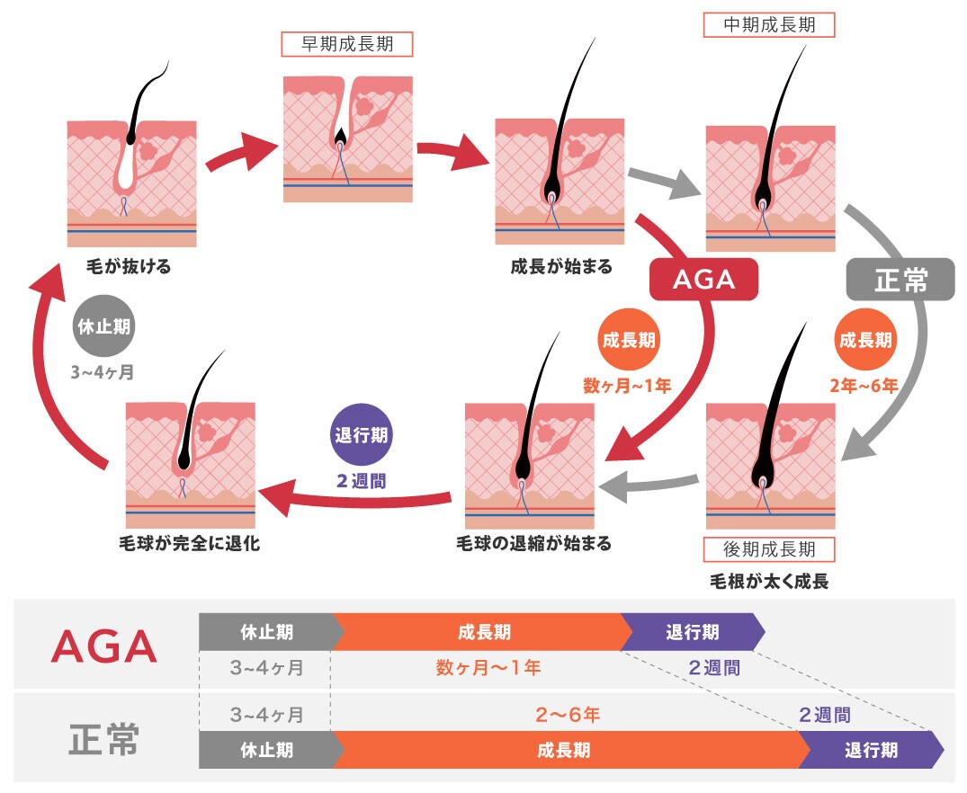 AGA・FAGA共通の仕組みとリスク