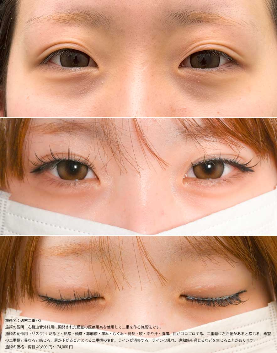 週末症例