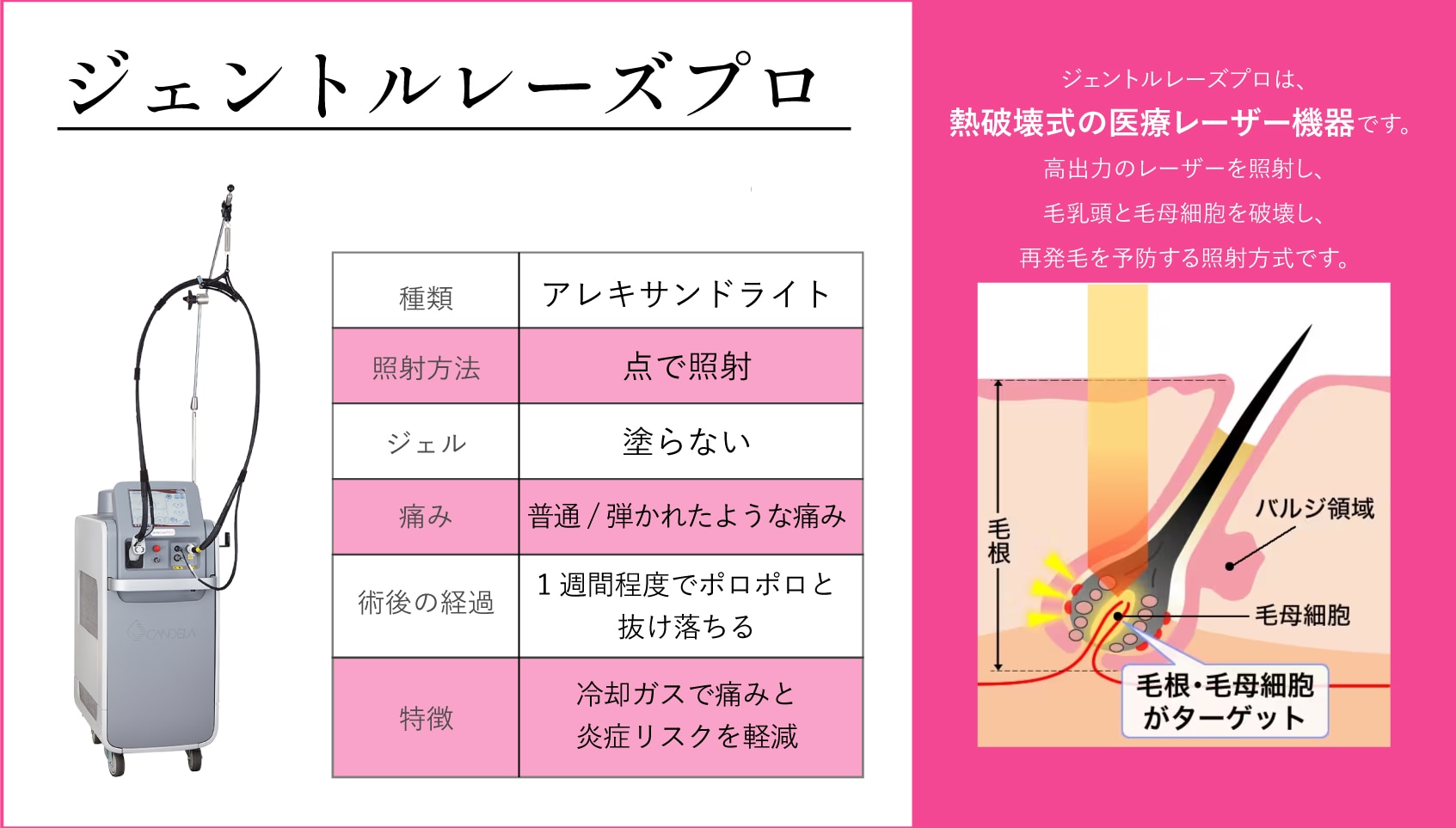 短期間で確実な脱毛効果が実感！【ジェントルレーズプロ】<br />
