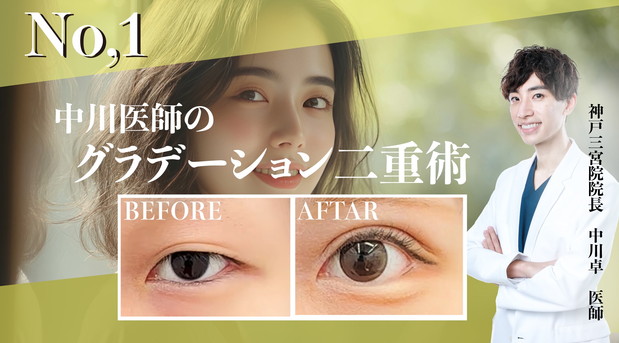ナチュラルなのに印象的な目元に。初めての美容整形としても人気No.1！