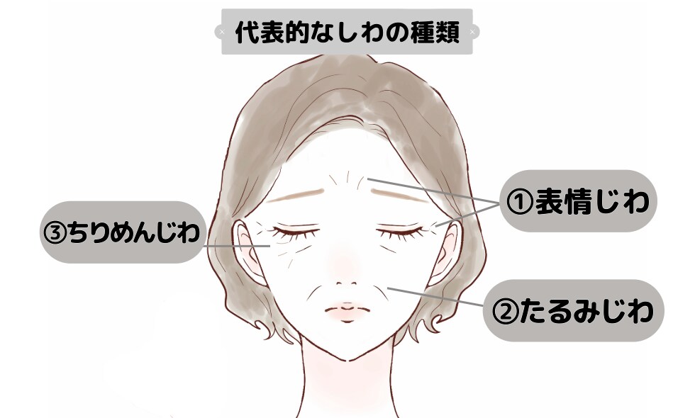 あなたのしわはどのタイプ？