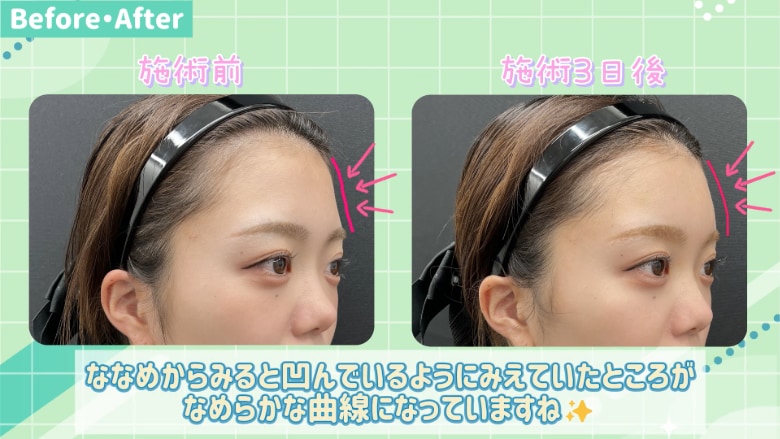 ななめ