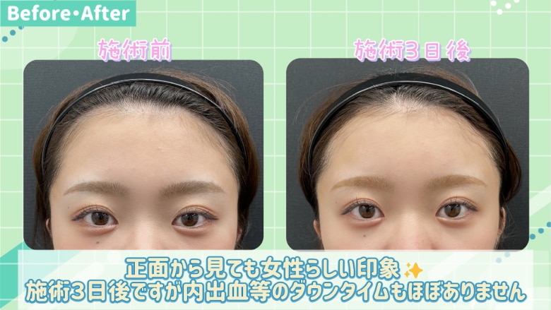 正面