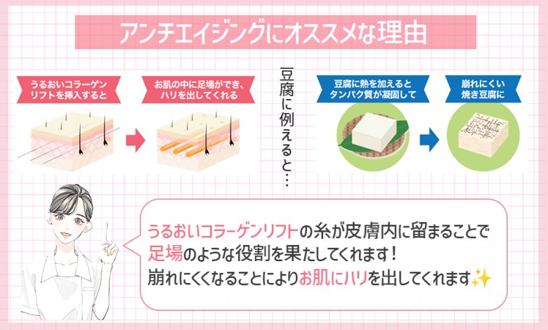 アンチエイジングにいい理由