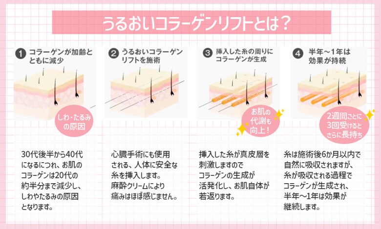 うるおいコラーゲンリフトでコラーゲンの生成が活発化！