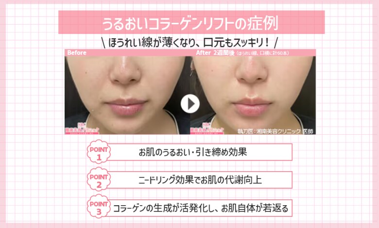 うるおって、引き締めてくれる✨