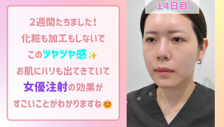 女優注射の効果がこちら！
