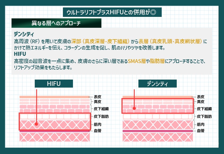 ウルトラリフトプラスHIFUと併用がおすすめ！