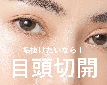【湘南美容クリニック小倉院】福岡・北九州・山口で目頭切開|一気に垢抜けて横幅しっかりダイヤモンドEYEへ