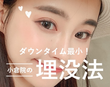 【二重埋没法】湘南美容クリニック小倉院｜福岡・北九州・山口で切らずに理想の二重整形
