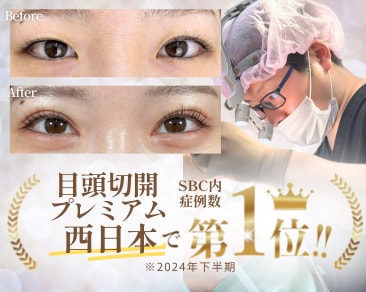 小倉院が福岡で【目頭切開】に選ばれる理由！岩間医師による“バレない整形”とは？