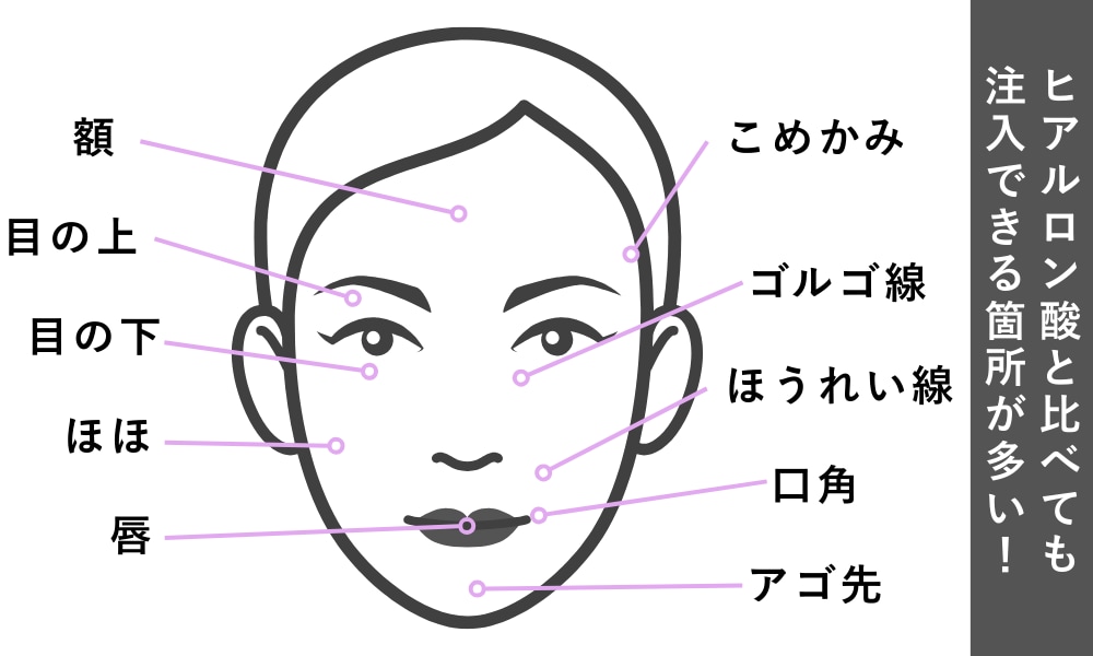 注入可能部位