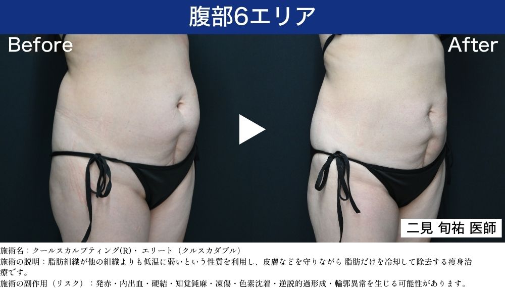 腹部