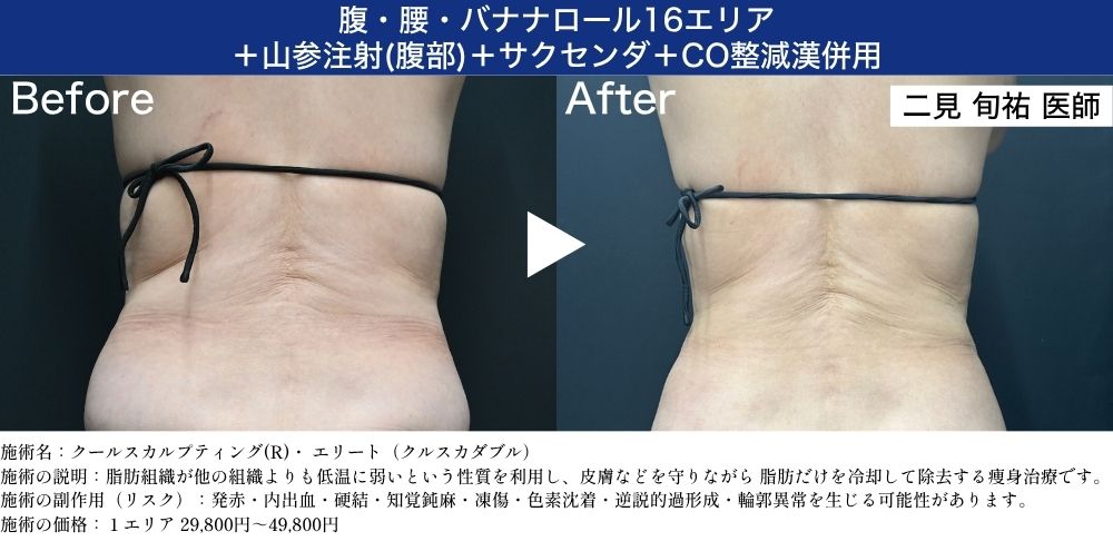 腹・腰・バナナロール