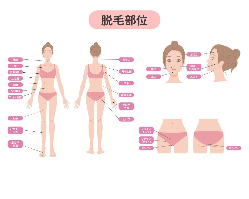 選べる脱毛部位
