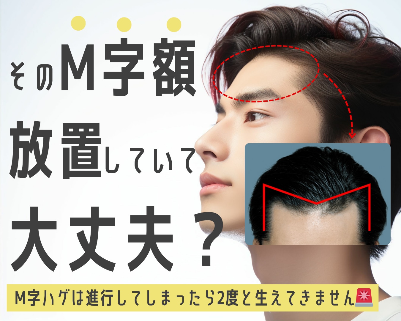 男性のM字悩み、湘南美容クリニック郡山院で解決できます!