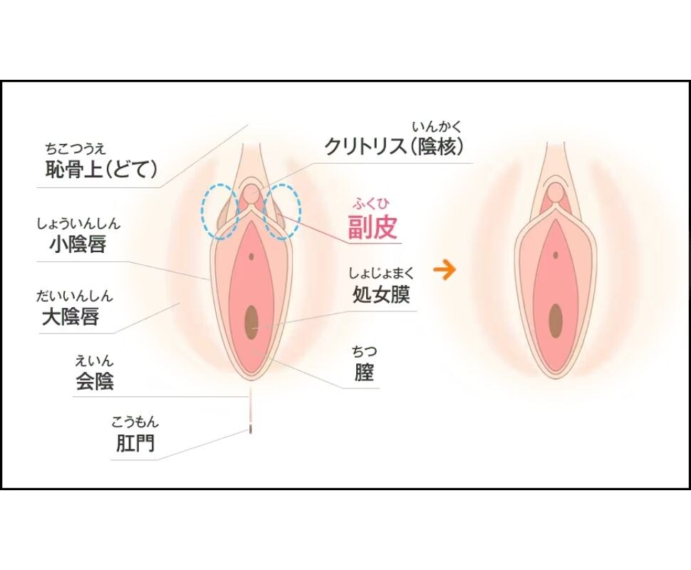 【副皮除去】大きさや匂いが気になる方へ