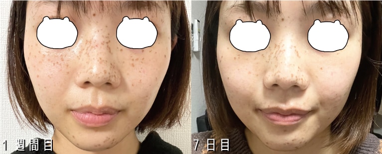 1週間目・7日目