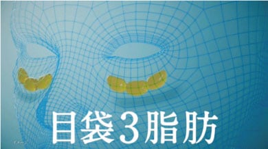 ズバリ、脂肪が原因