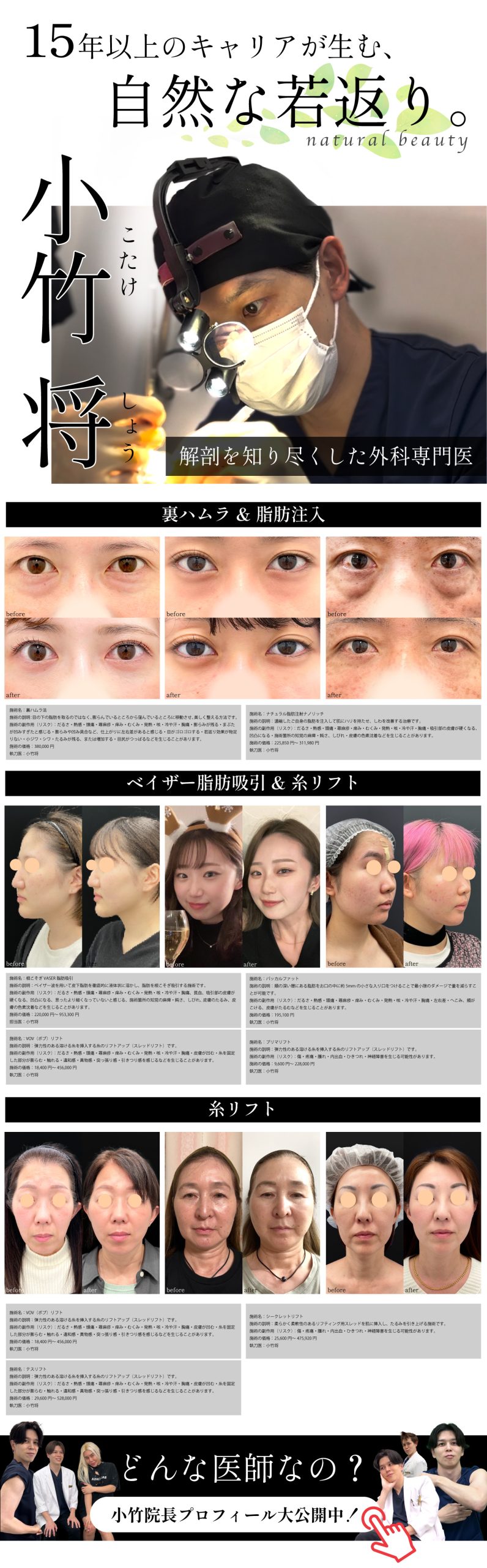 顔のつくりをよく知っているからこそ、やりすぎない仕上がりに。