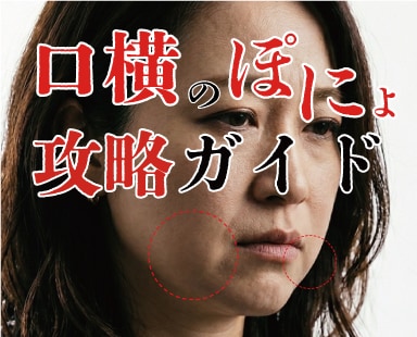口横のぽにょ攻略ガイド！外科専門医が原因と治療方法を解説します。湘南美容クリニック熊谷院