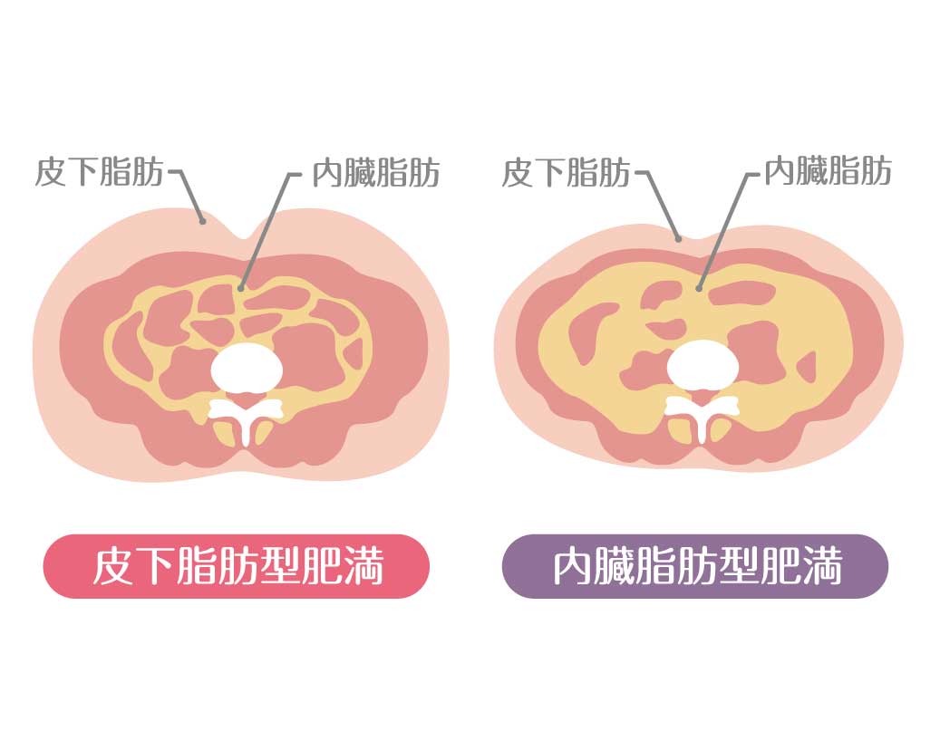 脂肪には大きく2種類ある！あなたの気になる脂肪はどちら？