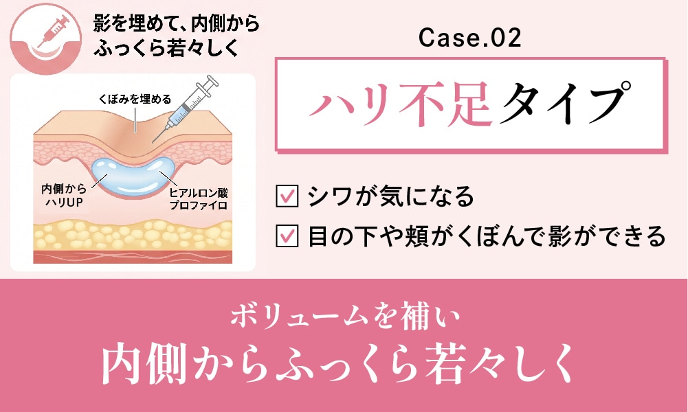 【ボリュームを補う】 影を埋めて、内側からふっくら若々しく