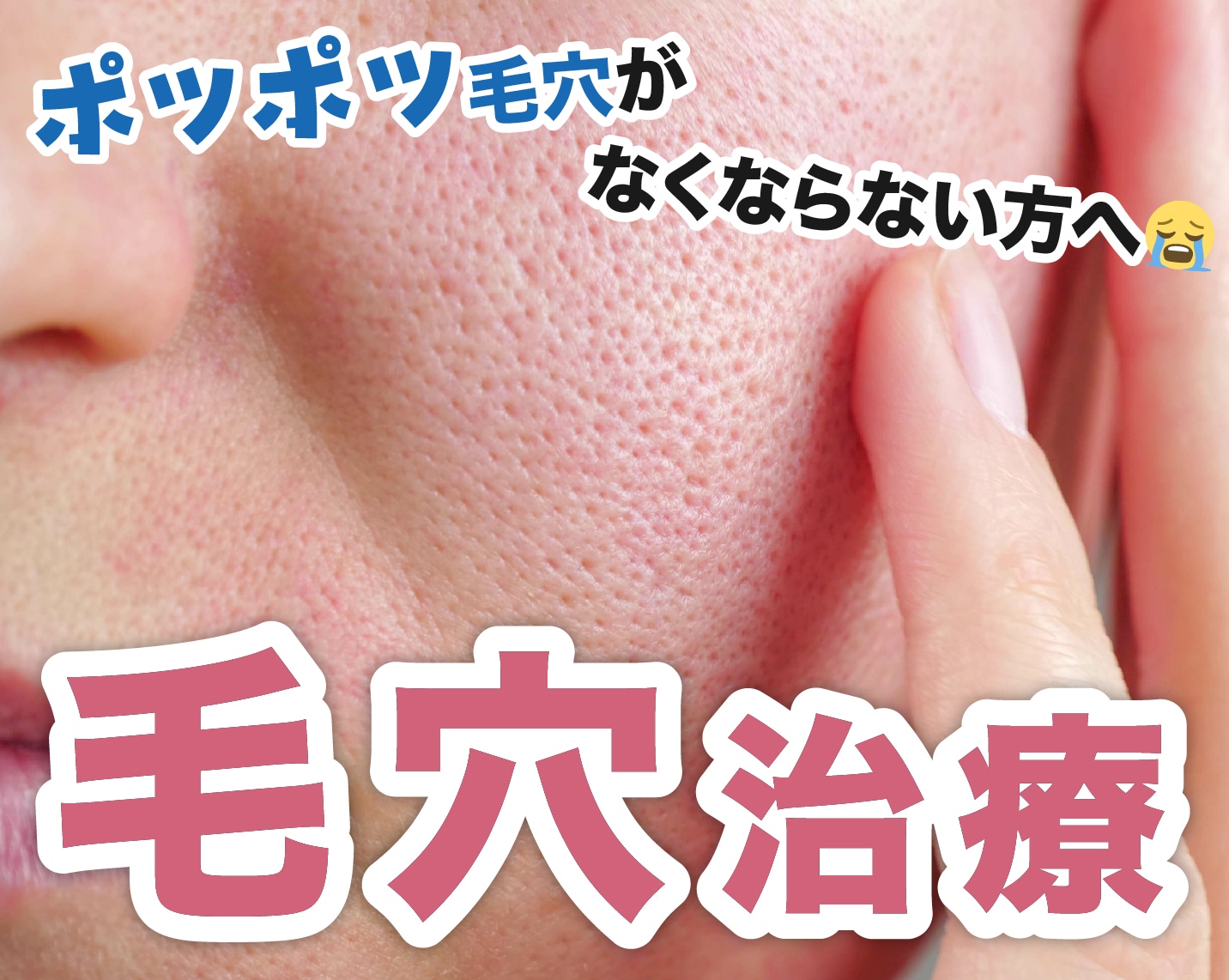 【熊本】もう毛穴で悩まない!毛穴治療11種類をわかりやすく解説♪