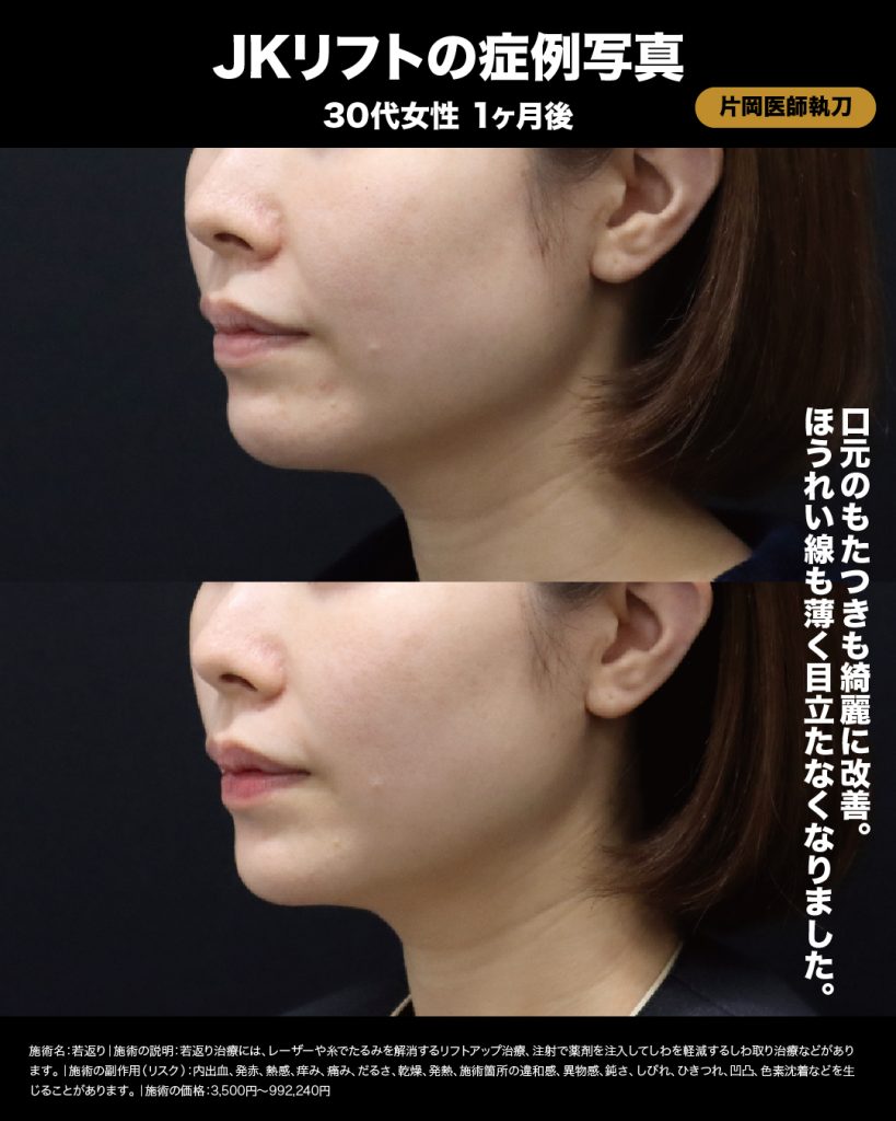 症例2