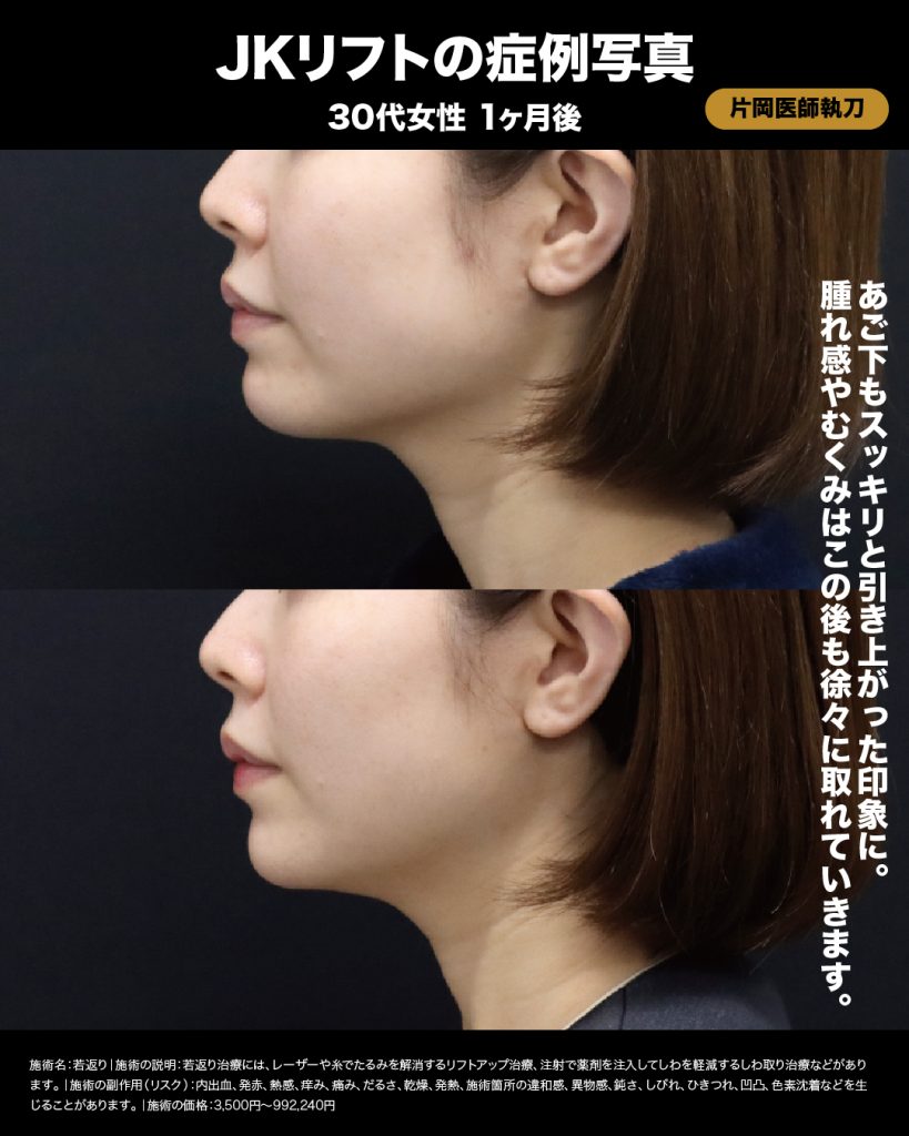 症例3