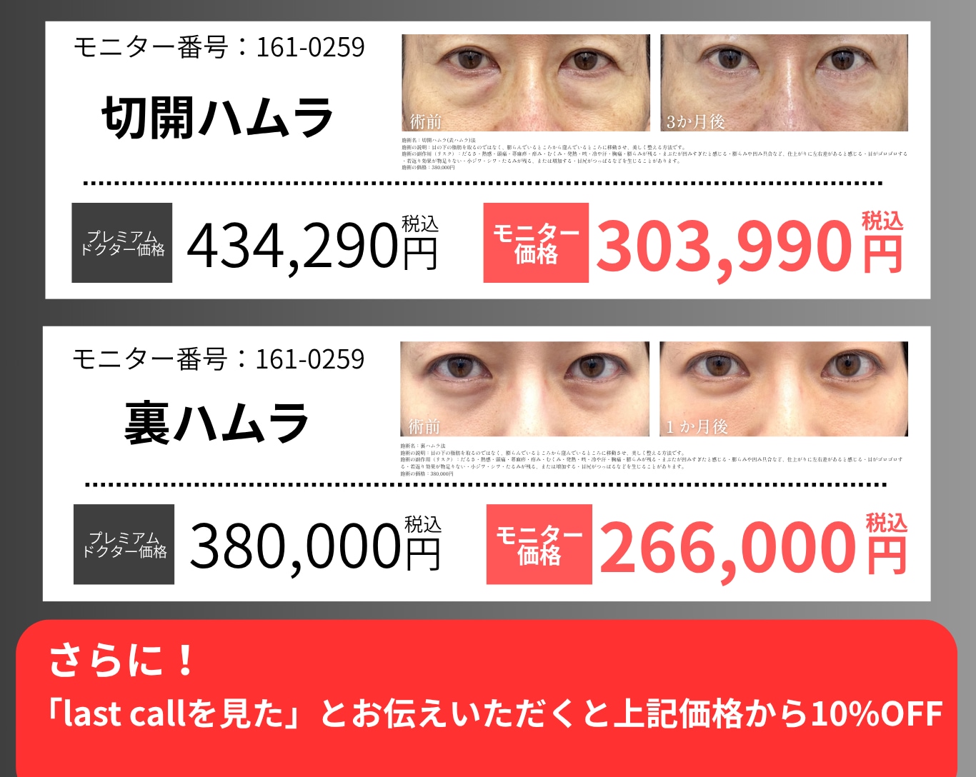 目の下のクマ・たるみ