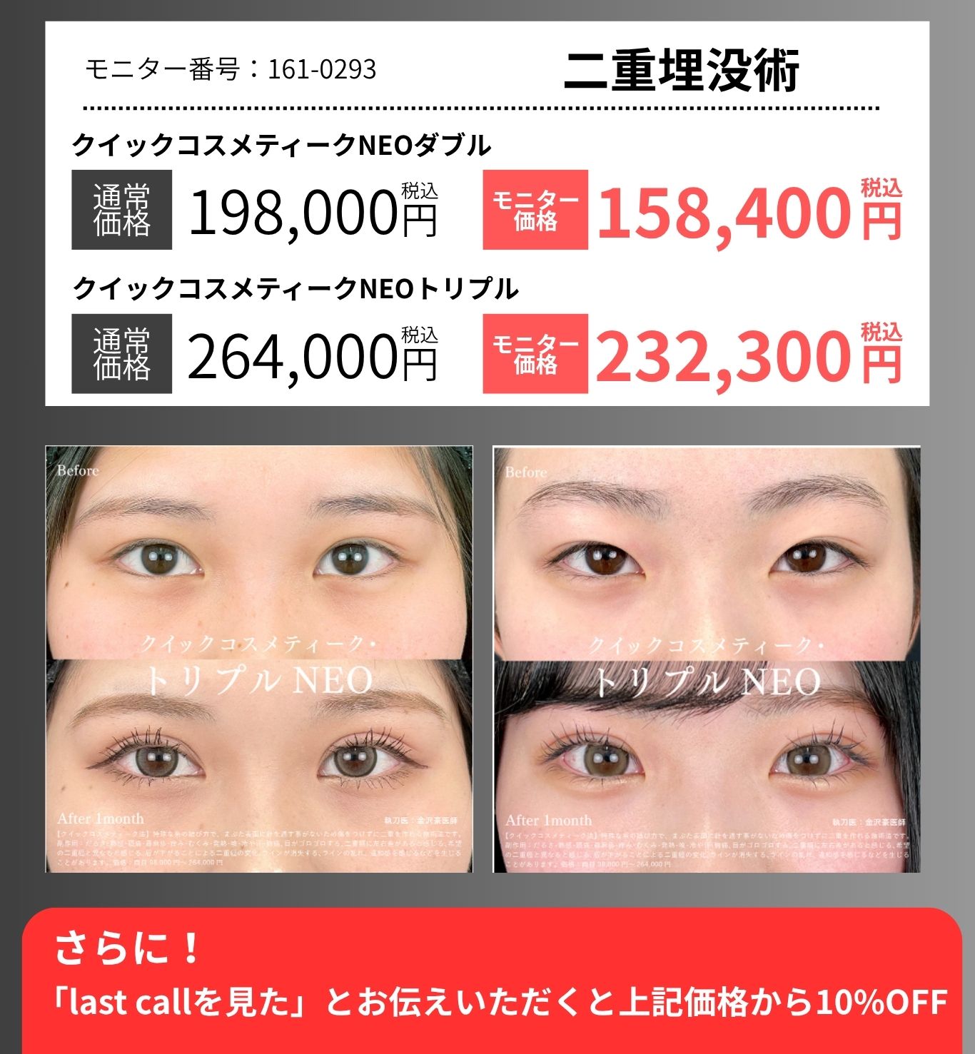 二重埋没術