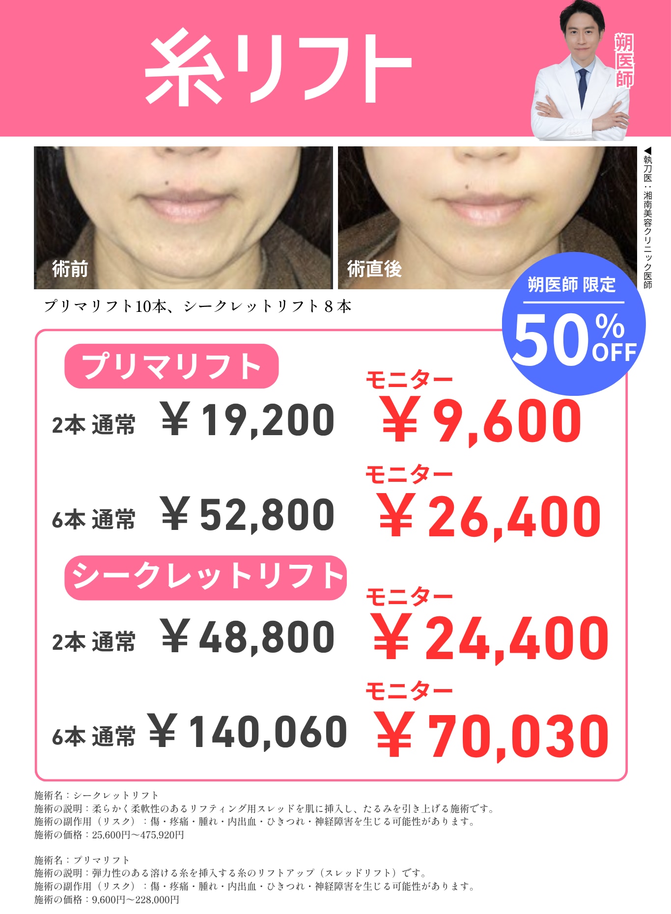 バレずに小顔に！